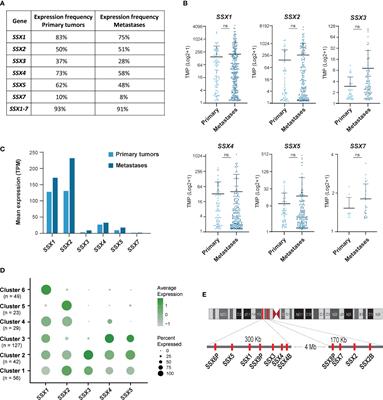 SSX addiction in melanoma propagates tumor growth and metastasis